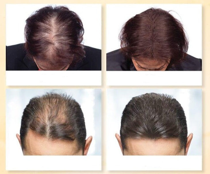 Natural Anti Hair Loss Oil